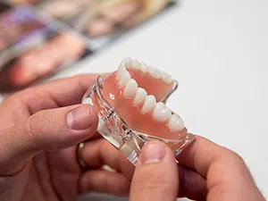 Full Mouth dental implant cost