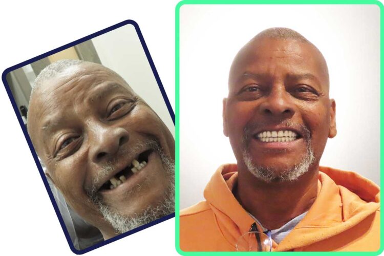 Dental Implant North Lauderdale Patient