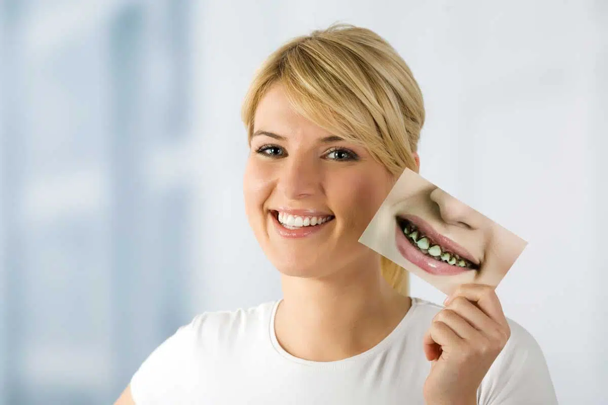 Smile Makeover North Lauderdale